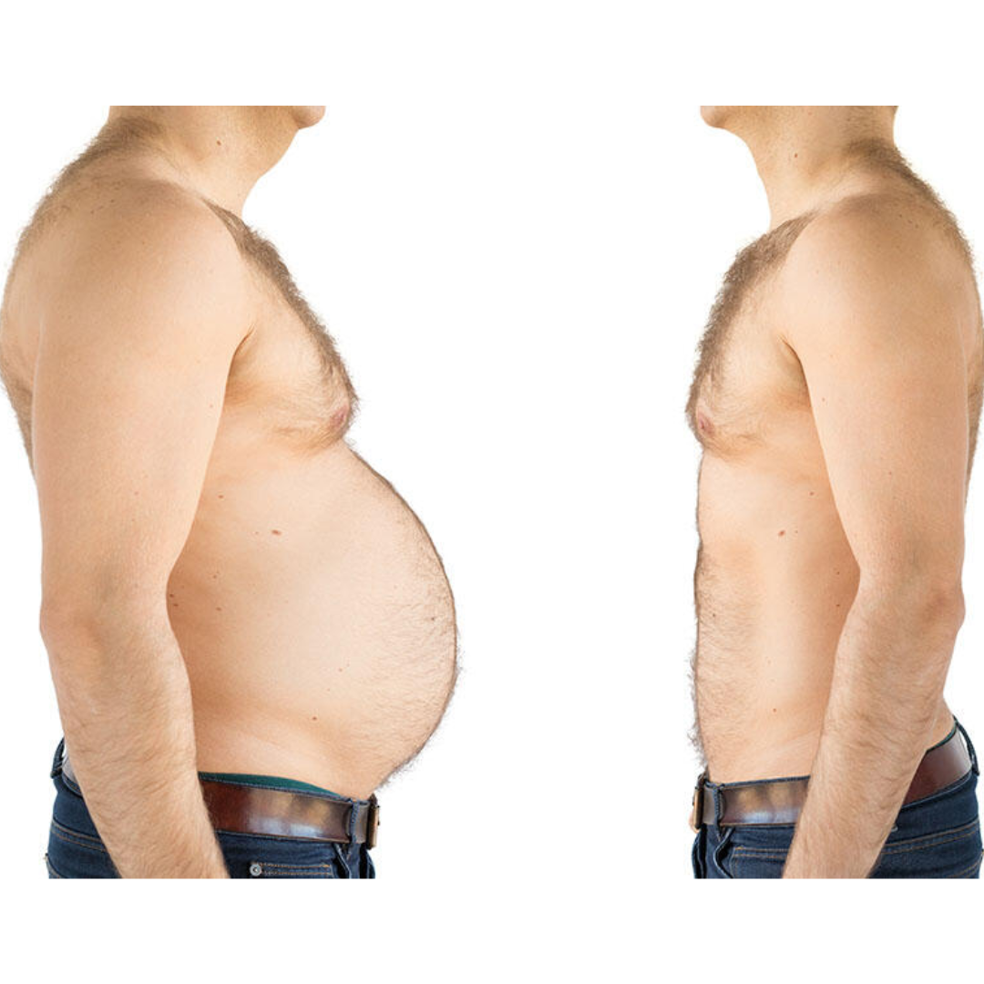 Suplemento natural para la pérdida de peso